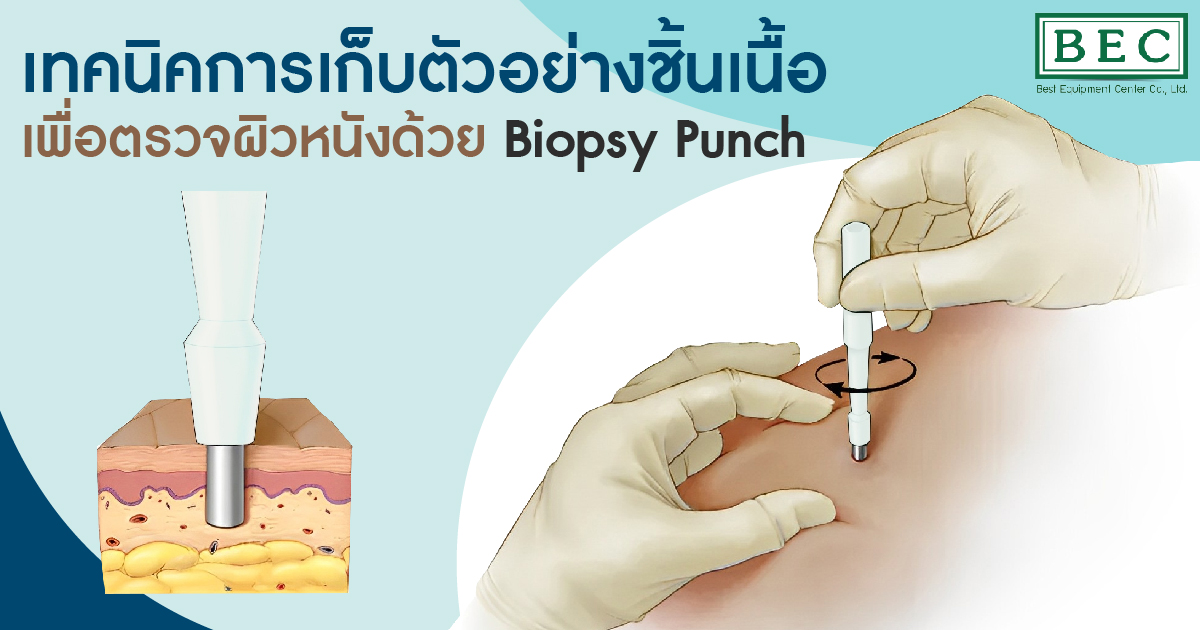 การทำ skin biopsy จะช่วยให้สัตวแพทย์วินิจฉัยโรคทางผิวหนัง Best